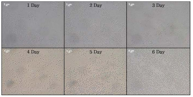 Bacillus cereus 배양일수에 따른 spore의 형성 양상