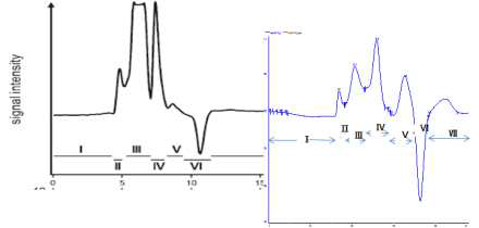 GPC chromatogram 비교.