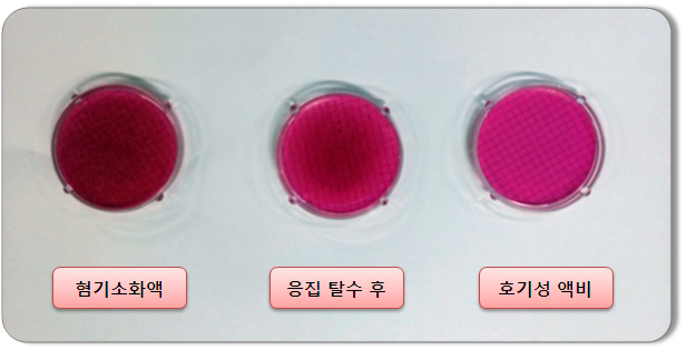 대장균 추정시험 결과