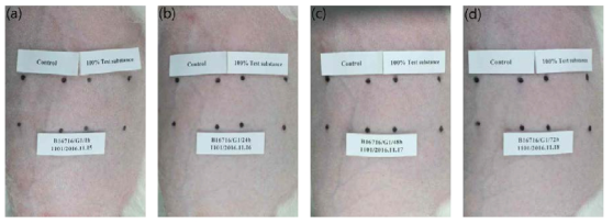 피부자극 및 부식성 평가결과: 후코이단 반폐색첩포 4시간 적용 뒤 (a) 1시간, (b) 24시간, (c) 48시간, (d) 72시간 후 피부반응 사진