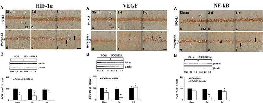 일시적 전뇌허혈 동물모델에서 IPC 적용에 따른 HIF-1α의 발현 변화 및 VEGF, NF-kB 발현 조절