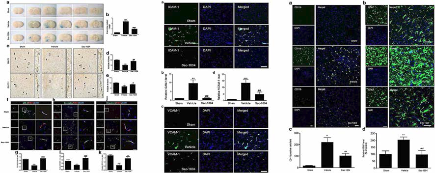일시적 국소허혈 동물모델에서 sac-1004의 혈관투과성 증가 및 BBB integrity 유지 관련 단백질 degradation 억제(왼쪽), 세포부착분자의 발현 증가 억제(중간) 그리고 신경아교세포의 활성화 억제(오른 쪽) 효과 확인