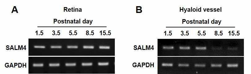 쥐의 망막과 hyaloid 혈관에서 SALM4의 발현 분석