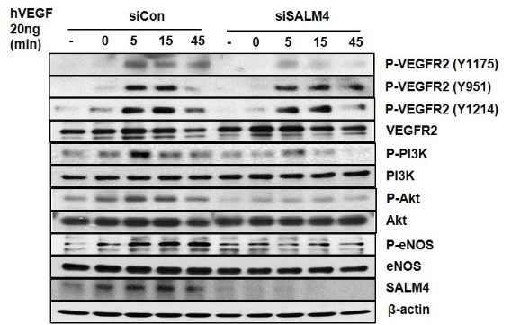SALM4를 knock down 한 HUVEC에서 VEGFR2의 신호전달 분석