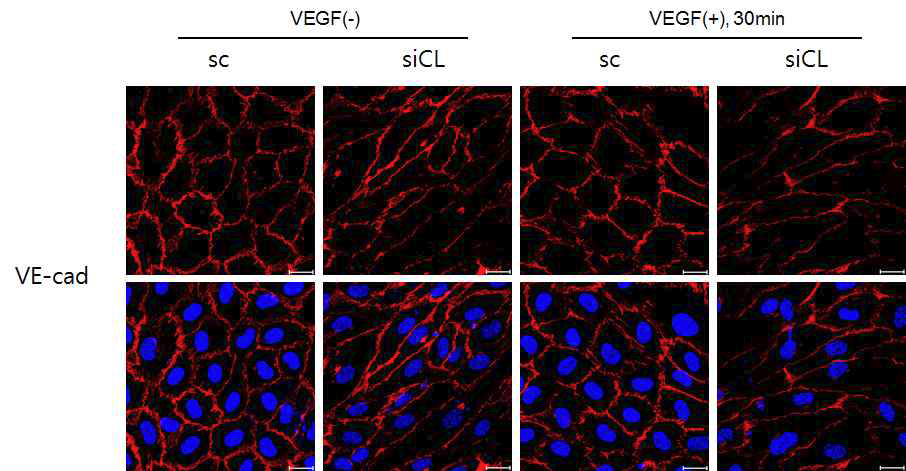 VE-cadherin단백질 면역형광염색을 통한 혈관내피세포의 접합 정도 확인