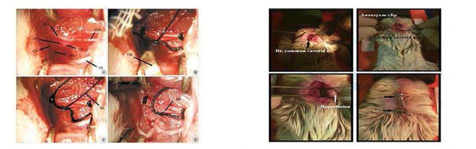 SD rat의 중대뇌동맥 폐쇄를 통한 일시적 국소허혈 동물모델(왼쪽) 및 Mongolian gerbil의 양 쪽 온목동맥 결찰을 통한 일시적 전뇌허혈 동물모델(오른쪽)