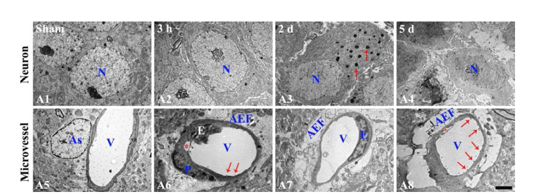 일시적 전뇌허혈 유발 후 해마 CA1 영역에서 신경세포 및 BBB 구성세포의 전자현미경적 미세 구조