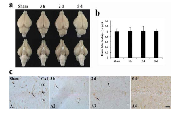 일시적 전뇌허혈 유발 후 evans blue 양 및 IgG의 면역반응성의 변화 분석
