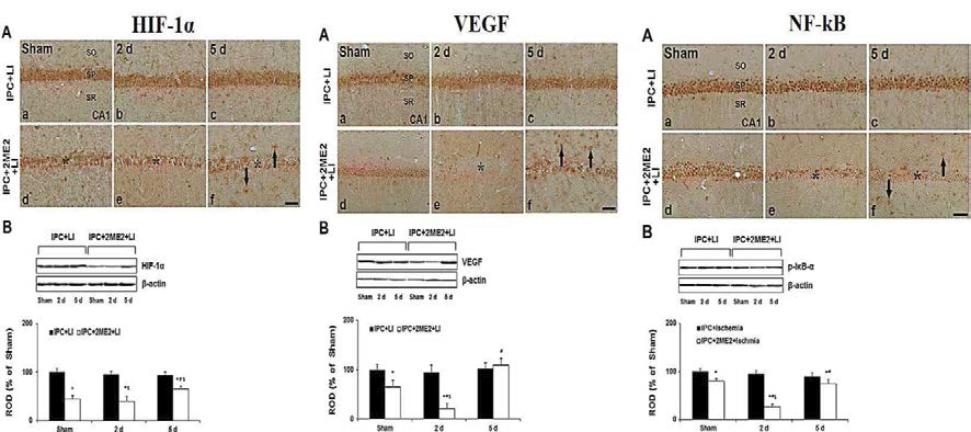 일시적 전뇌허혈 동물모델에서 IPC 적용에 따른 HIF-1α의 발현 변화 및 VEGF, NF-kB 발현 조절