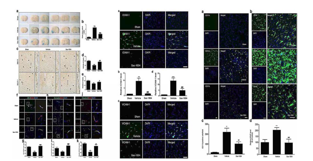 일시적 국소허혈 동물모델에서 sac-1004의 혈관투과성 증가 및 BBB integrity 유지 관련 단백질 degradation 억제(왼쪽), 세포부착분자의 발현 증가 억제(중간) 그리고 신경아교세포의 활성화 억제(오른 쪽) 효과 확인