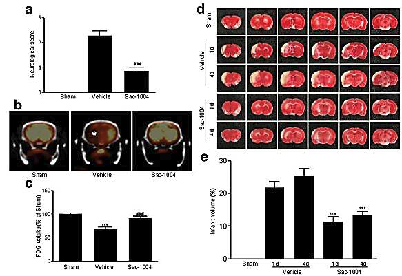 일시적 국소허혈 동물모델에서 sac-1004의 신경보호 효과