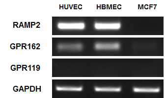 내피세포와 암세포에서의 RAMP2, GPR162, GPR119의 발현