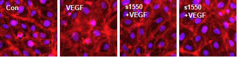 f-actin염색을 통한 s1550가 actin-ring 구조 유지에 대한 효과 확인