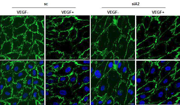 VE-cadherin 염색을 통한 세포간 접합능력 확인