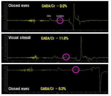 자극에 따른 후두엽 부위의 GABA 신호 관찰