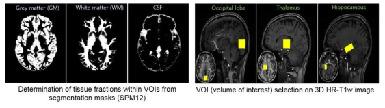 s-MRI 영상에서 만든 회백질, 백질 및 뇌 척수액 확률분포맵 (좌)와 sMRI 영상에서 선택한 영역별 마스크 (우)