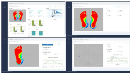 발 측정 데이터 측정 이미지 / 이미지는 측정 완료 후 측정자의 발 데이터 정보 제공