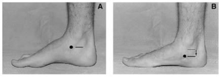 Navicular drop 테스트