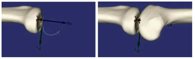 Spline joint 모델로 표현한 femorotibial joint