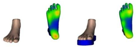 족부-인솔 시물레이션: (좌) 인솔이 없이 바닥에 떨어졌을때의 발바닥의 압력 분포, (우) 인솔이 있을시 발바닥의 압력 분포