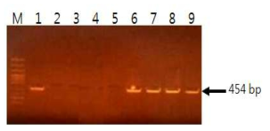9종의 표준균주를 대상으로 한 β-galactosidase의 PCR 검출.