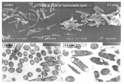 Salmonella typhi의 SEM과 TEM사진