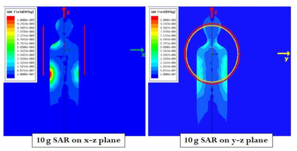 13.56 MHz 자기공진형 시스템의 SAR 계산 결과(1 Watt 공급시)