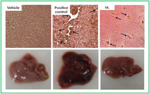 Sepsis 동물모델에서 뽕잎(상황버섯균사)발효분말의 간손상 억제 효과