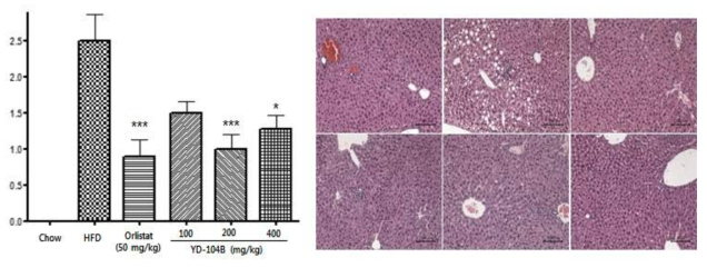 8주간 HFD 유도 및 orlistat 또는 YD-104B 투여군의 개체로부터 분리된 간조직에 서의 지방증 (steatosis) 발현 비교