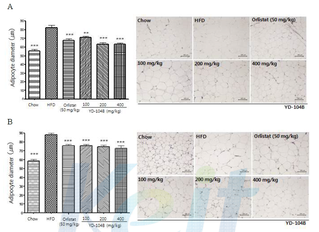 8주간 HFD 유도 YD-104B 투여군의 개체로부터 분리된 부고환지방조직 (A. Epididymal) 및 후복강막조직 (B. Retroperitoneal)에서의 지방세포의 크기