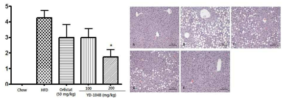 비만 유도된 마우스로부터 분리된 간조직의 지방증(steatosis) 발현