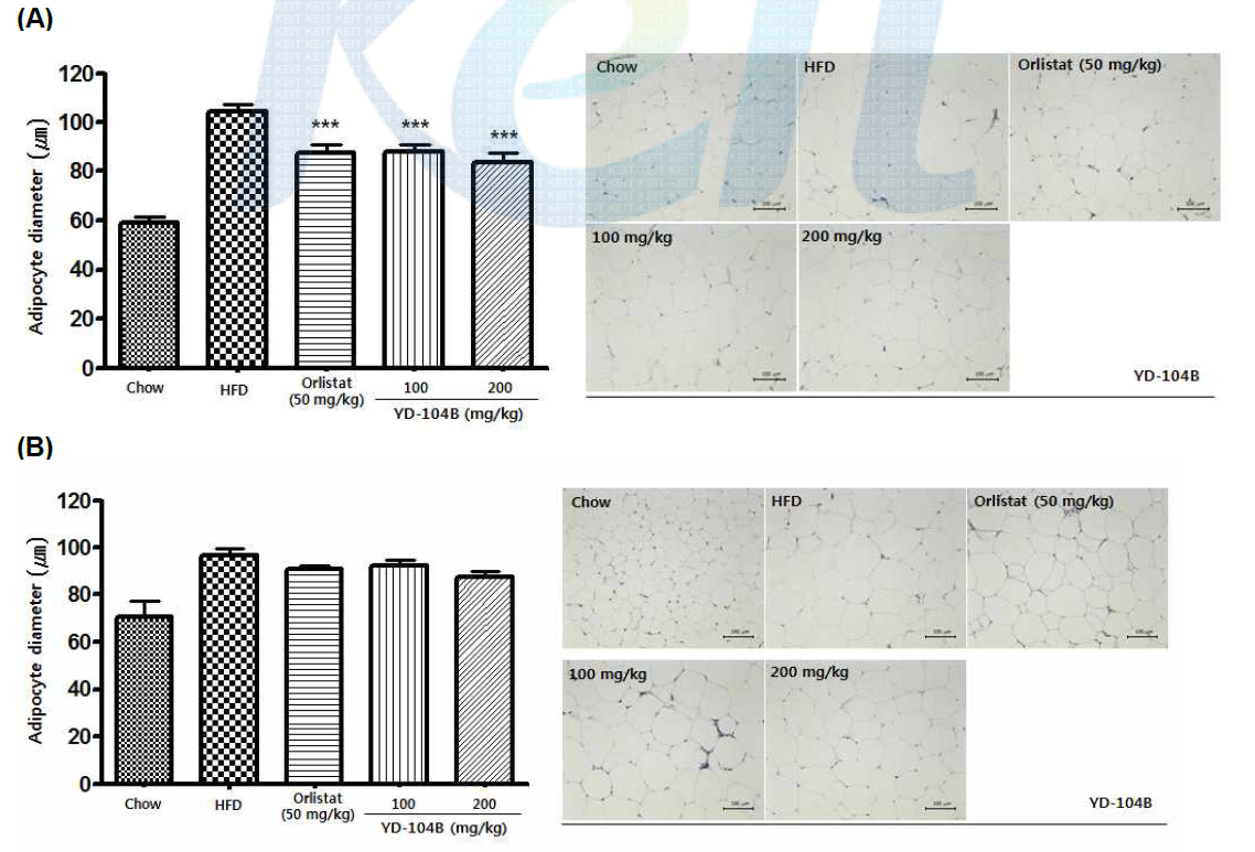 비만 유도된 마우스로부터 분리된 부고환지방조직(A) 및 후복강지방조직 (B)에서의 지방세포 크기 비교