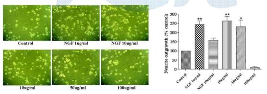 Comparison of effect of neurite outgrowth on Neuro-2A cells cultured for 24 h following concentration of treatment of FSO (10, 50, 100ug/ml).