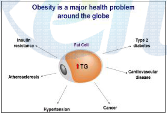 비만과 대사증후군의 관계