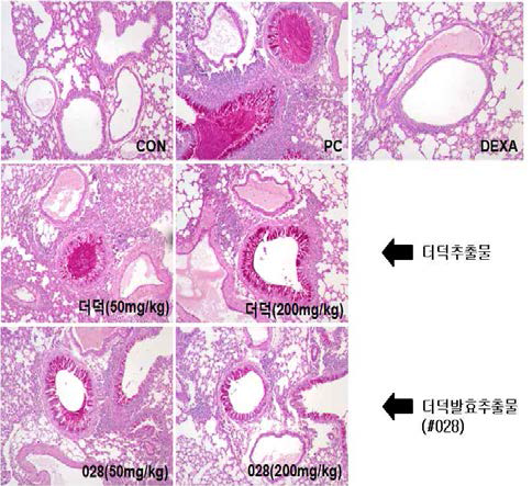 Staining observations of PAS of unfermented deodeok and #028 sample.