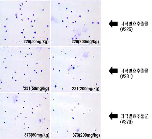 Distribution pattern observations of eosinophil of #226, #231 and #373 sample.