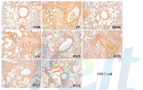 Immunostaining observations of CD8 T cell.