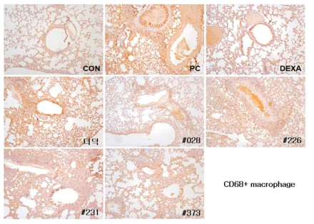 Immunostaining observations of CD68+ macrophage.