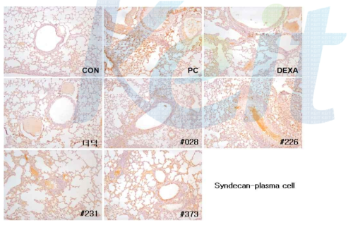 Immunostaining observations of syndecan-plasma cell.