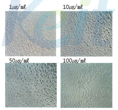 Shape of A549 cell by concentration of extract