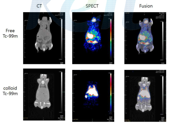 Free Tc-99m 및 Colloid Tc-99m의 이미지