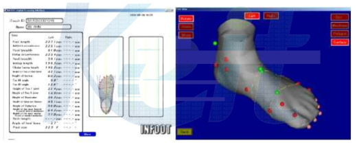 Infoot S/W 상에서의 계측 결과 및 Iso-view of Foot view