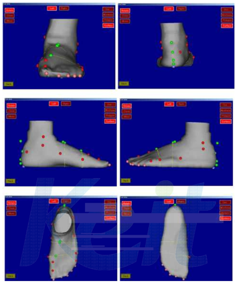 계측된 발의 형상