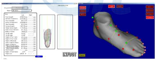 Infoot S/W 상의 계측 결과 및 Iso-view of Foot view