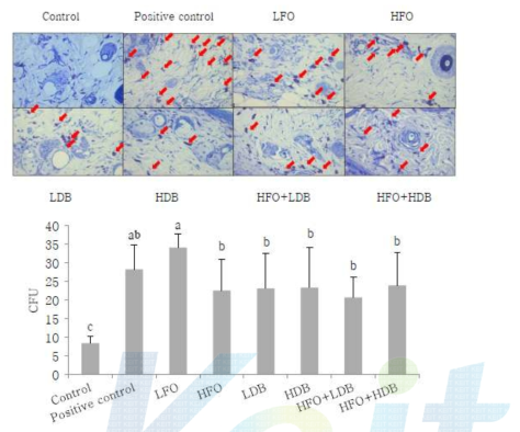 Infiltration of mast cells