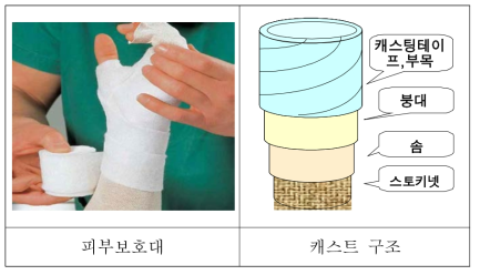 피부보호대와 기존 캐스트 구조