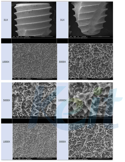 SLA 표면 처리한 임플란트의 SEM 사진