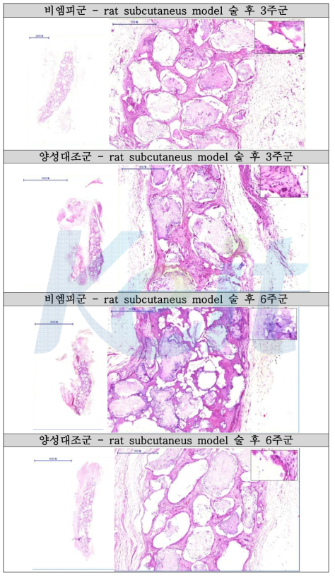 Rat subcutaneous model을 이용한 복합체로 구성된 골이식물의 조직학적 분석