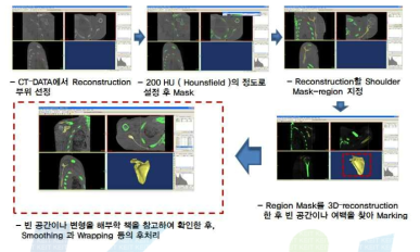 어깨 골격계 복원 과정