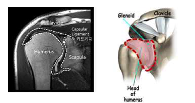 관절낭의 MRI Data(좌), 관절낭의 위치 및 형상(우)